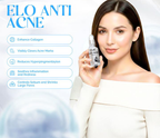 ELO Anti-Acne Serum - Clear Acne Marks & Pores (30ml)